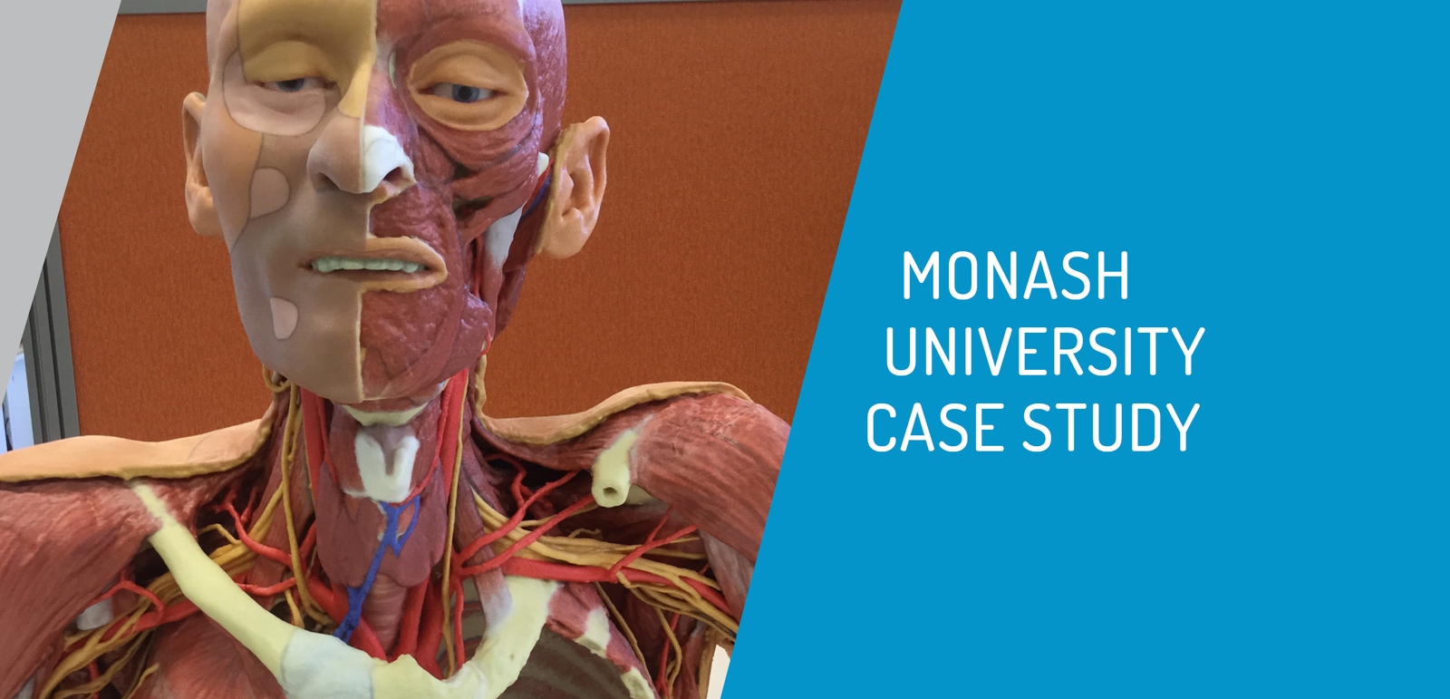 Monash Uni invest in new 3D printing technology to develop alternative teaching aids  
